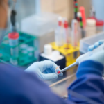 Registran 672 nuevos casos de Covid-19 este domingo por presencia de subvariante ómicron BA.5 en el país